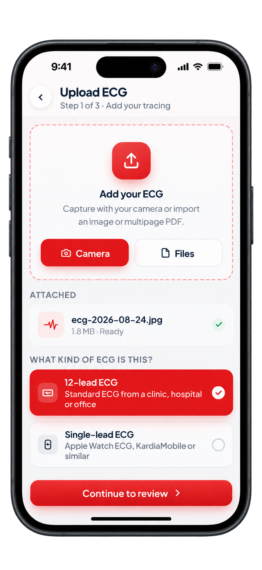 Kalbi app: Upload your ECG