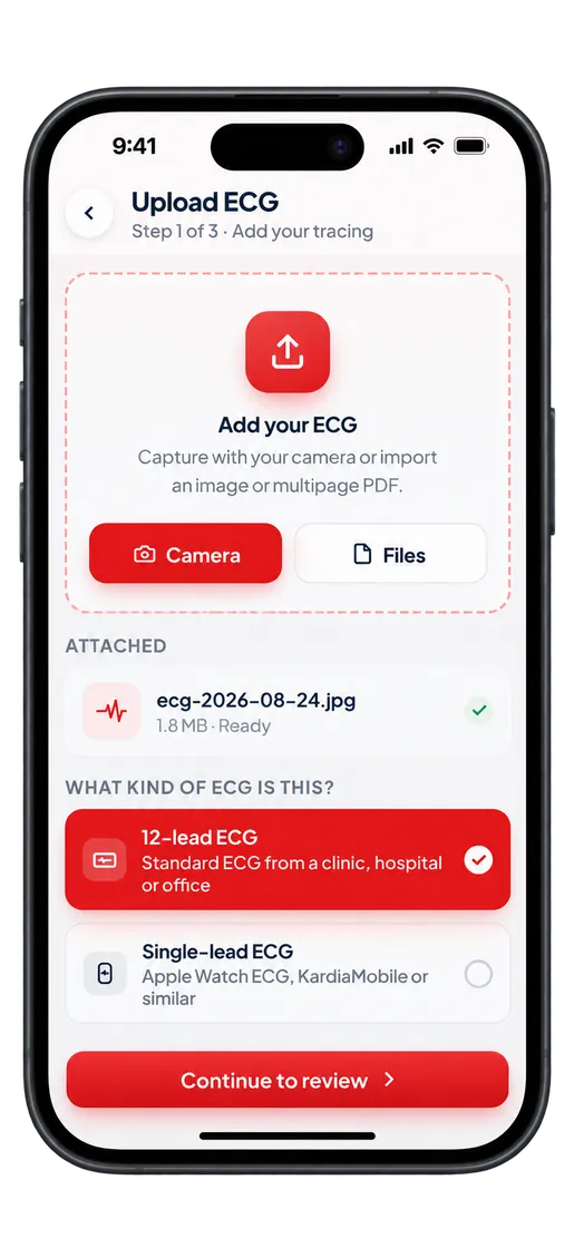 Kalbi upload screen with camera and file options