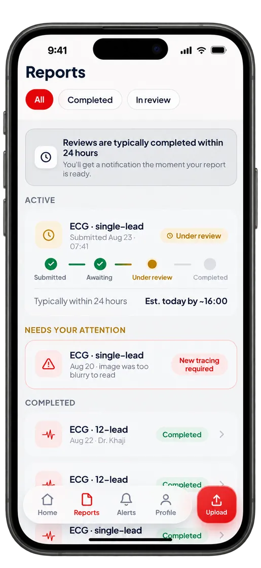 Kalbi app feature preview